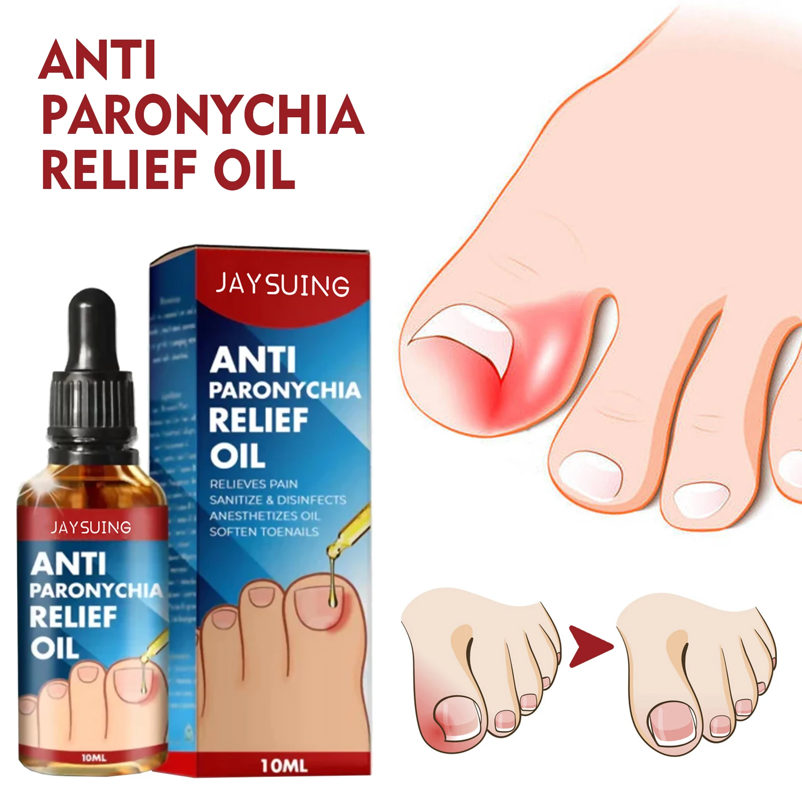 Jaysuing Nail Fungus Removal Oil Onychomycosis Fungal Treatment
