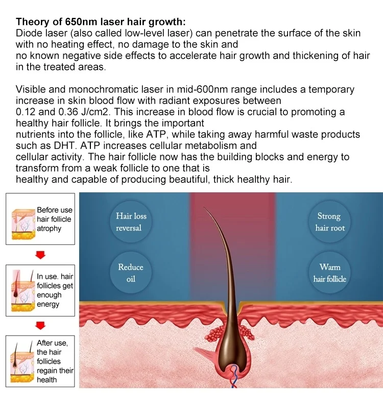 High-Efficiency Laser Beauty Machine for Hair Growth Treatment with Bio-Energy Low Level Laser Therapy Diode Laser 650nm