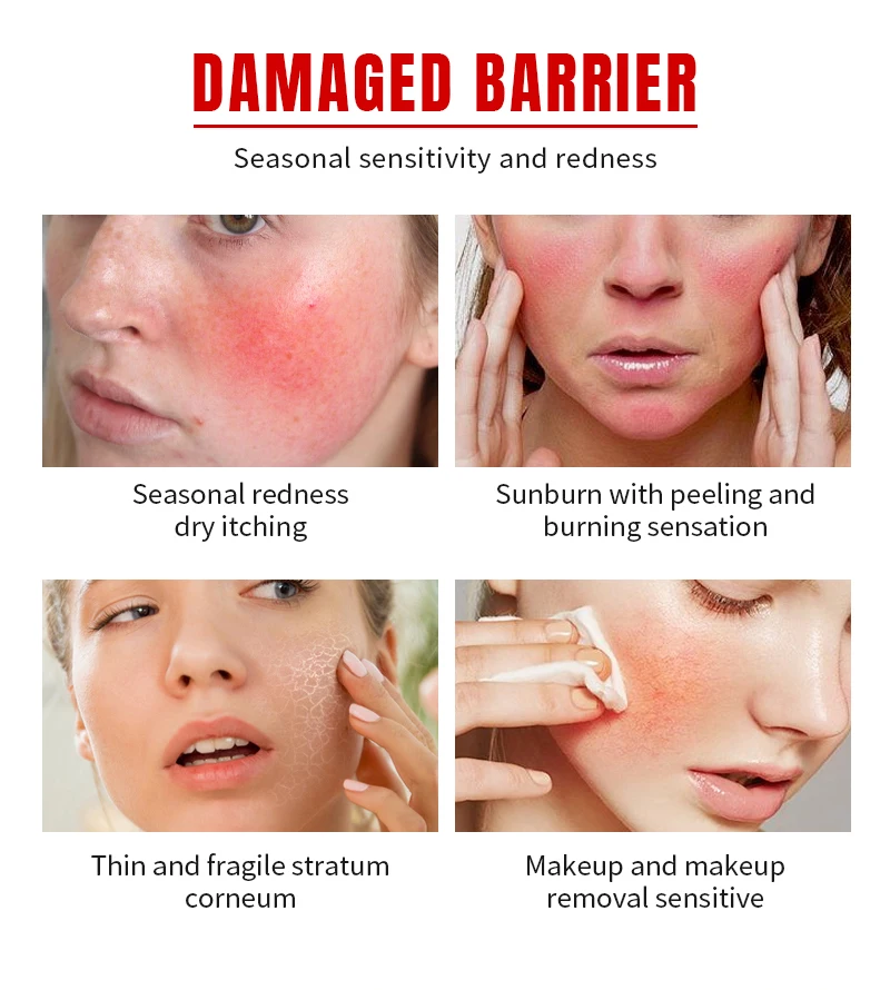 Oem Odm Skin Calming Face Cream Soothing Sensitive Skin Redness Relief