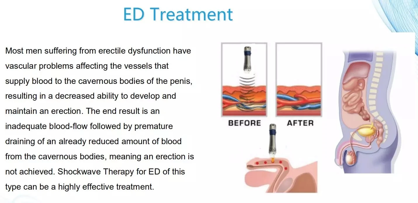 Ed meaning medical