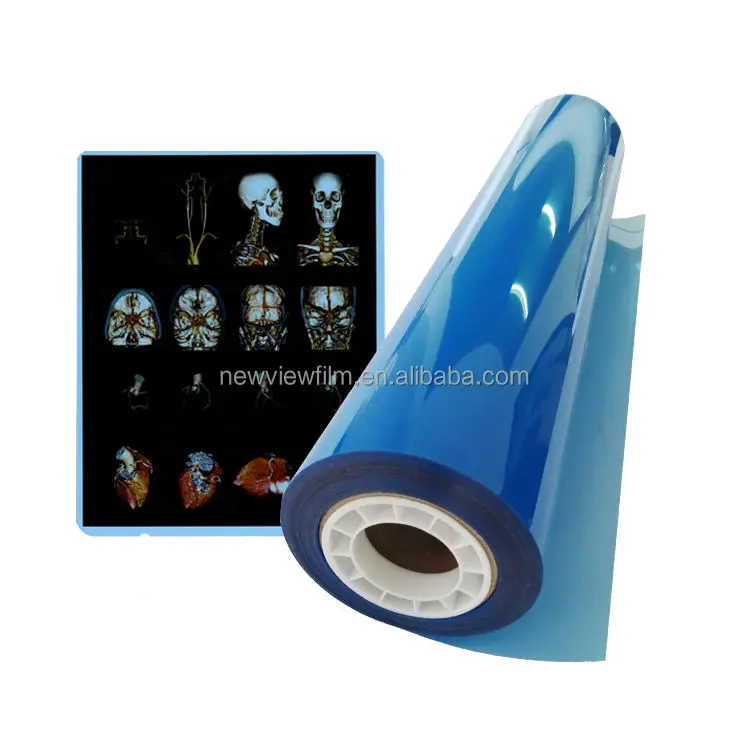 Imágenes médicas con película de rayos X de inyección de tinta térmica a base de PET azul para hospitales clínicos 0