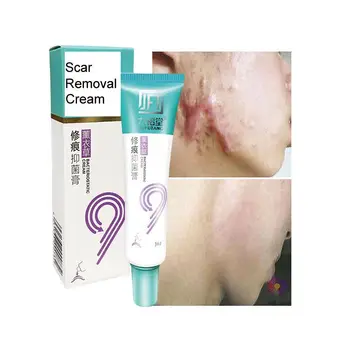 Scar Remover Acne Spots Treatment shrink Pores Gel Bleaching Creams Whitening Moisturizing Skin Repair removal scar cream
