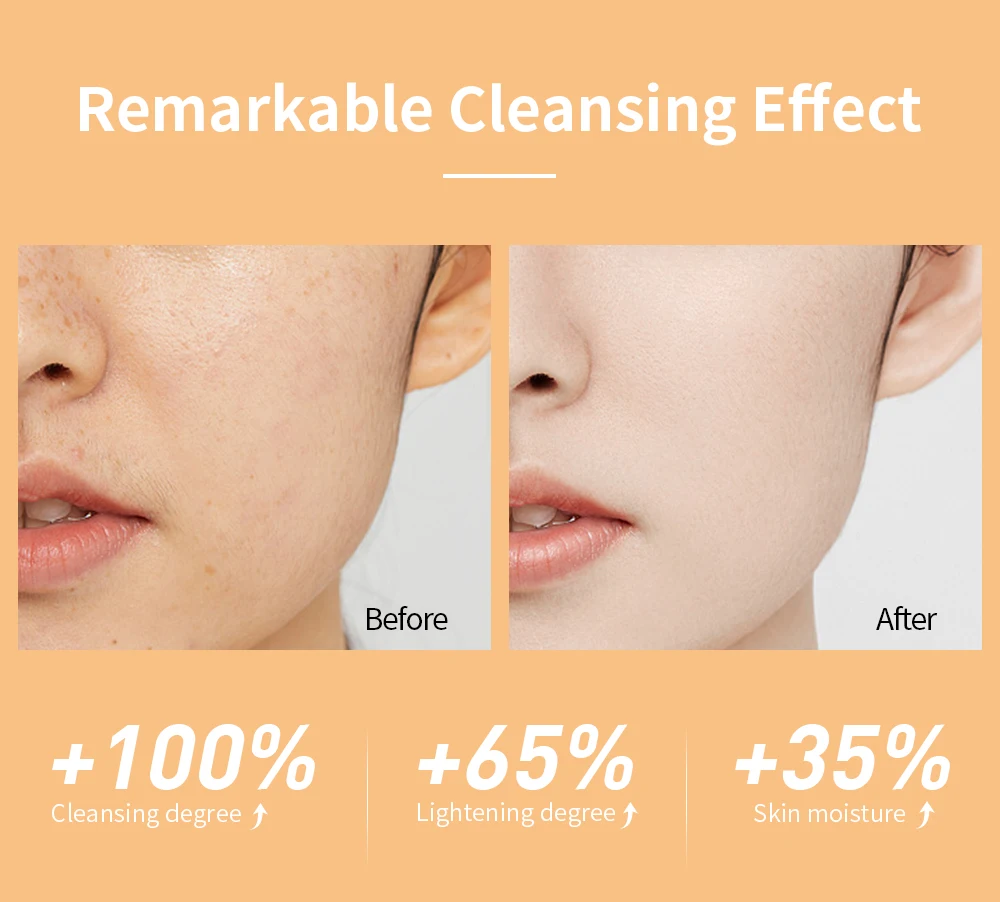 LANBENA Asta Tumeric Aspiradora De Centella Face Toner Thick Consistency Glow Recipe Watermelon Peeling Skin Toner