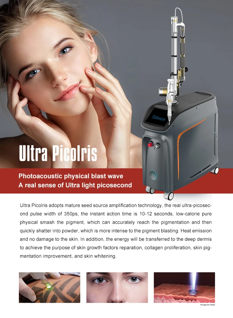 Ultra Picolris Diode Triple Wavelength Picosecond Laser Tattoo Removal ...