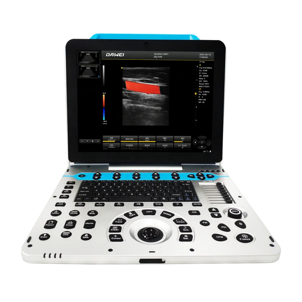 Портативная Высококачественная сердечно-сосудистая ветеринарная ультразвуковая система