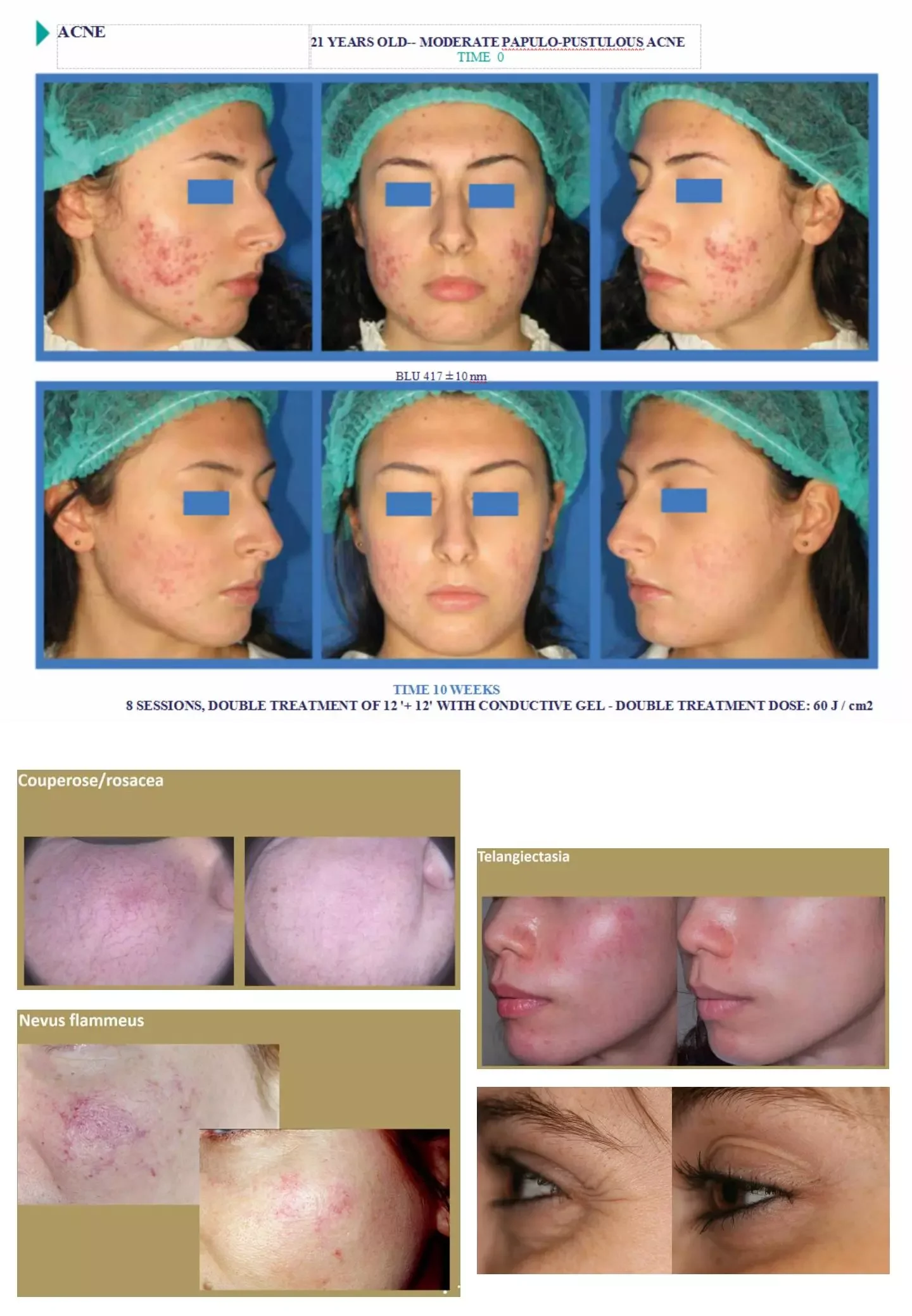 Kernel Hydraskincare PDT LED Light Photodynamic Facial Skin Care Rejuvenation Led Face Light Therapy
