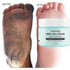 Urea + ácido salicílico