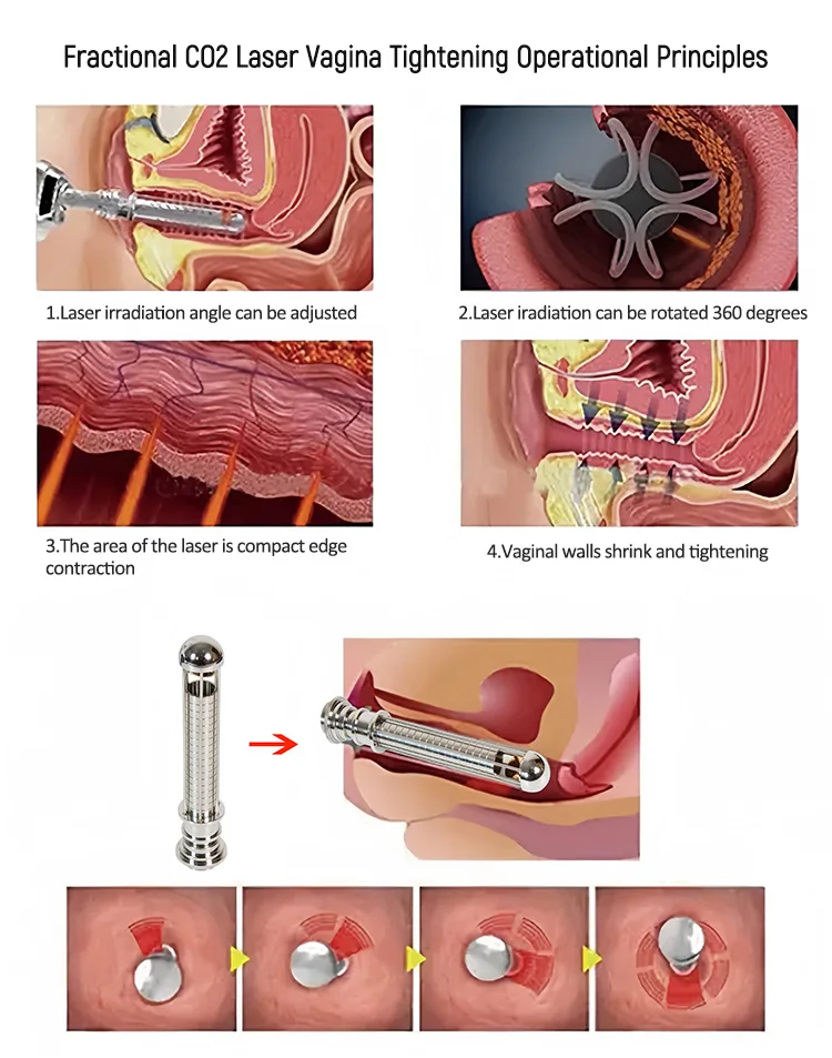 2 in 1 CO2 Fractional Laser+ Q Switch Skin Care Machine for Skin Carbon Peel Professional Fractional Skin Firm