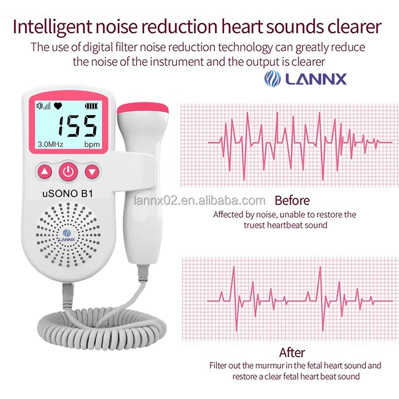 Lannx Usono B1 Ultrasonido Doppler Baby Heart Rate Detector Portable ...