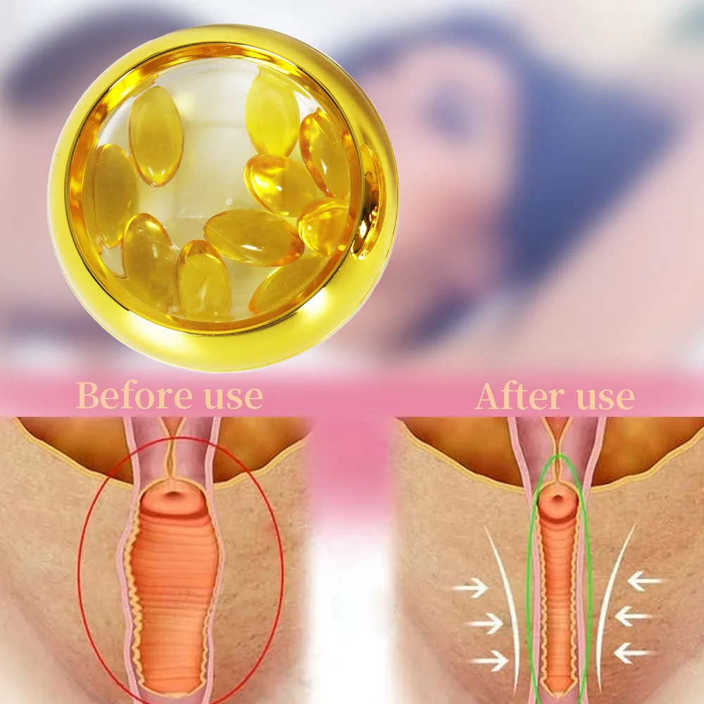 SereneCare Customized Logo 100% Chinese Herbal Women Vaginal Shrink Tightening Soft Capsules No Side Effect pH Balance