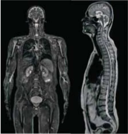 Hospital Medical Magnetic Resonance Imaging System 1.5T  MRI Machine with A-combi and Al Technologies manufacture