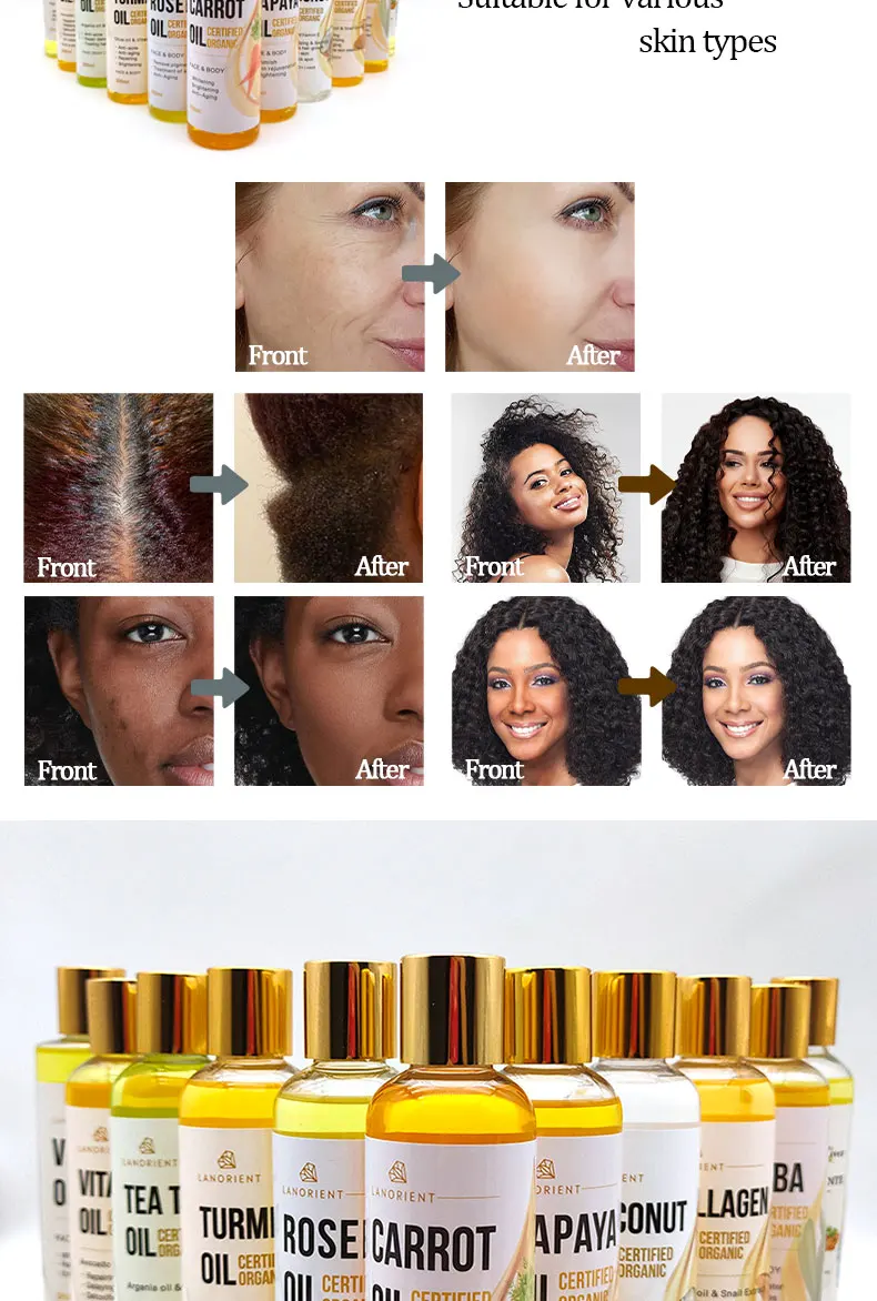 Custom Private Label Bulk Carrier Oils Organic Pure Avocado Almond