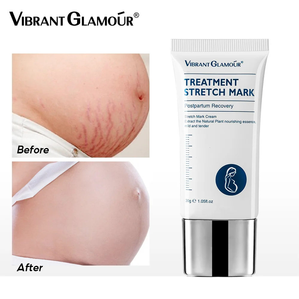 VIBRANT GLAMOUR Effective Anti Stretch Marks Scar Repair Stretch Marks Removal Cream