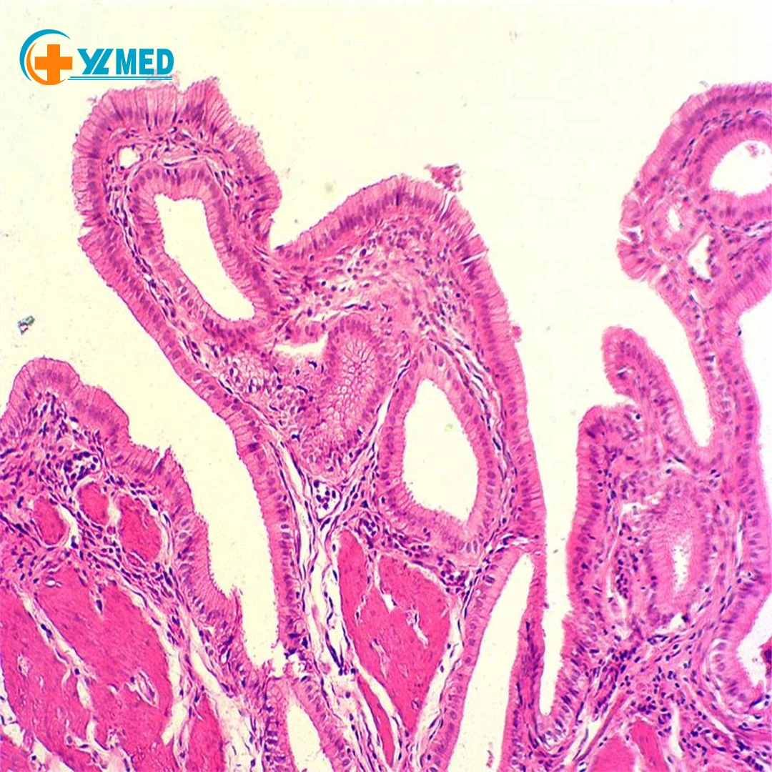 Fallopian tube histology hi-res stock photography and images - Alamy, image size:1080x1080