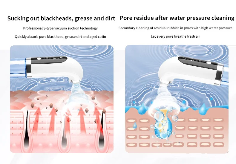 Electric Micro Small Bubble Water Cycle Acne Pimple Pore Vacuum