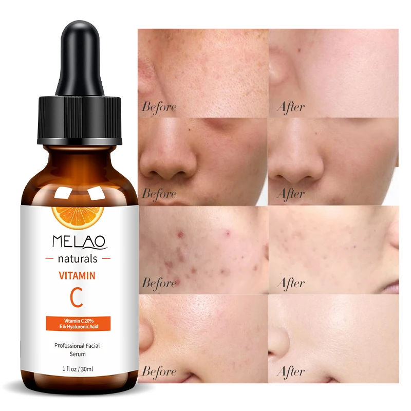 melanotan 2 nasal spray kit Buy Melanotan 2 Latvia Online. PharmaLabGlobal