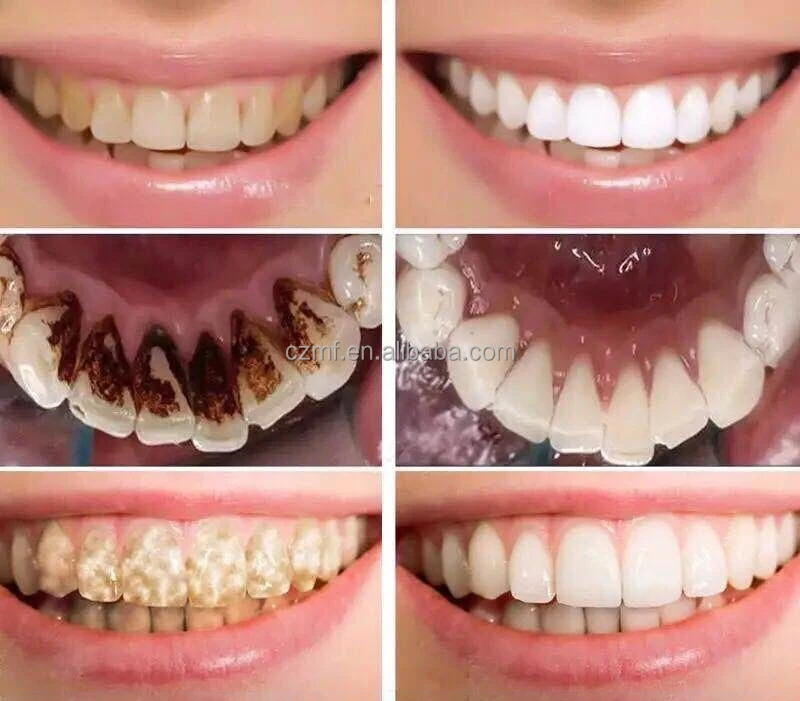 Private Label 250ML Natural Organic Teeth Whitening Oral Care Cleans Your Teeth Green Tea Mouthwash