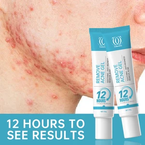 Cream Remove Pimples for Inflammatory to Back on Face Treat Oxy Marks Drying Spot and Dark Spots Cream Remove Pimples