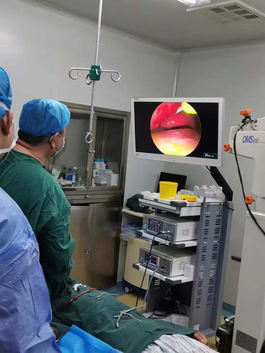 OM-822B артроскоп хирургические HD 720p камера эндоскоп