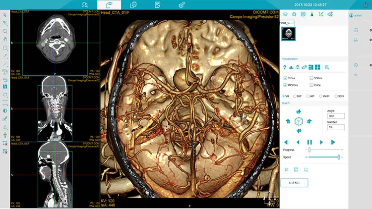 MSLCTX12 Medsinglong Computer Tomography 32-slice Spectral Imaging 2D 3D CT Scanner CT Machine for sale