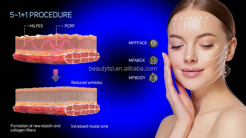 Magnetic Radiofrecuencia Radio Frequency Mf Face Massage Mffface For V Line Facial Face Neck