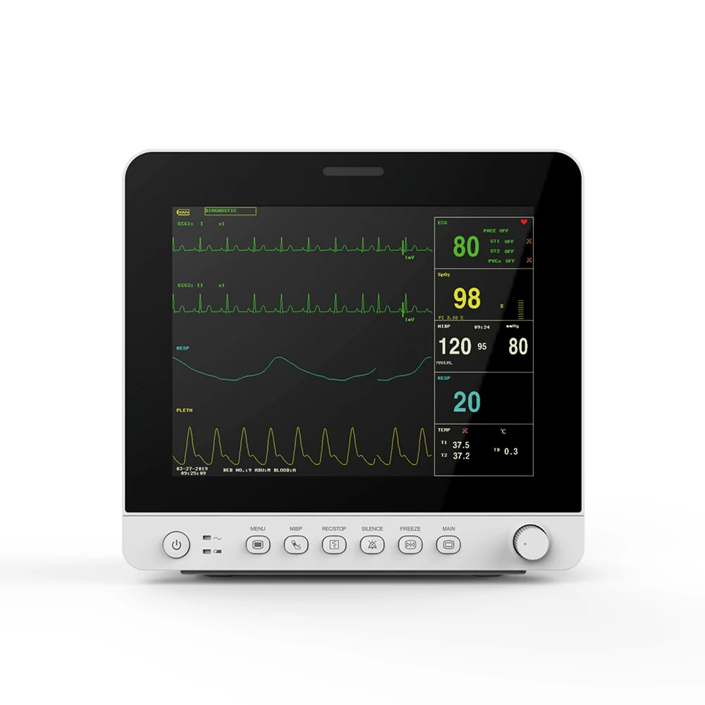 CONTEC монитор пациента vitals monitor со встроенной литиевой батареей настенное