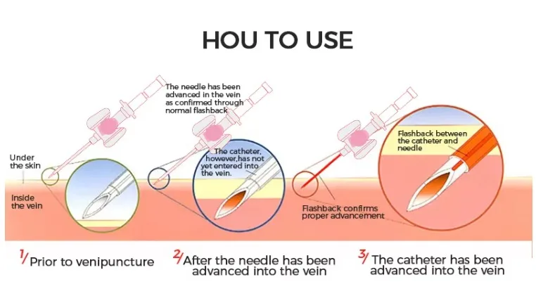 product-1-1 product-1-1