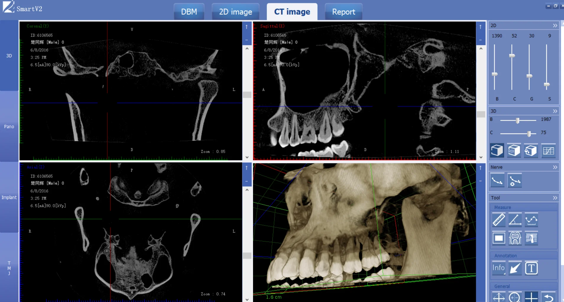 Factory Direct Hot Sale Hospital OPG Dental CBCT Panoramic Dental X Ray Machine Panoramic X Ray Machine Price