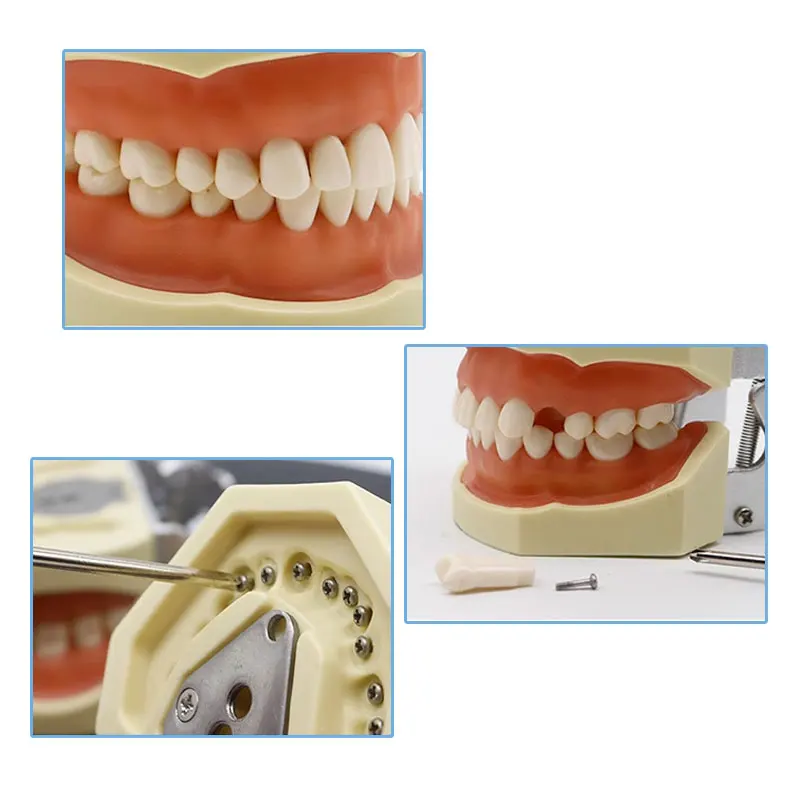 Factory Direct Removable Orthodontic Study Dentist Anatomical Oral Training Oral Tooth Model Dental Typodont Models Carton Box