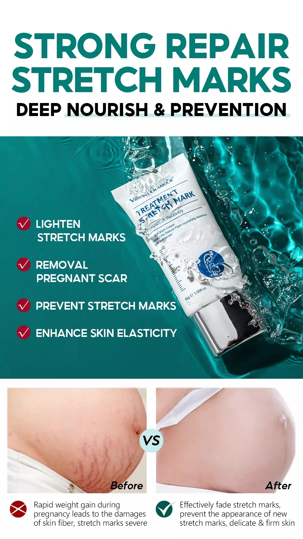 VIBRANT GLAMOUR Pregnancy Treatment Stretch Marks Cream 30g