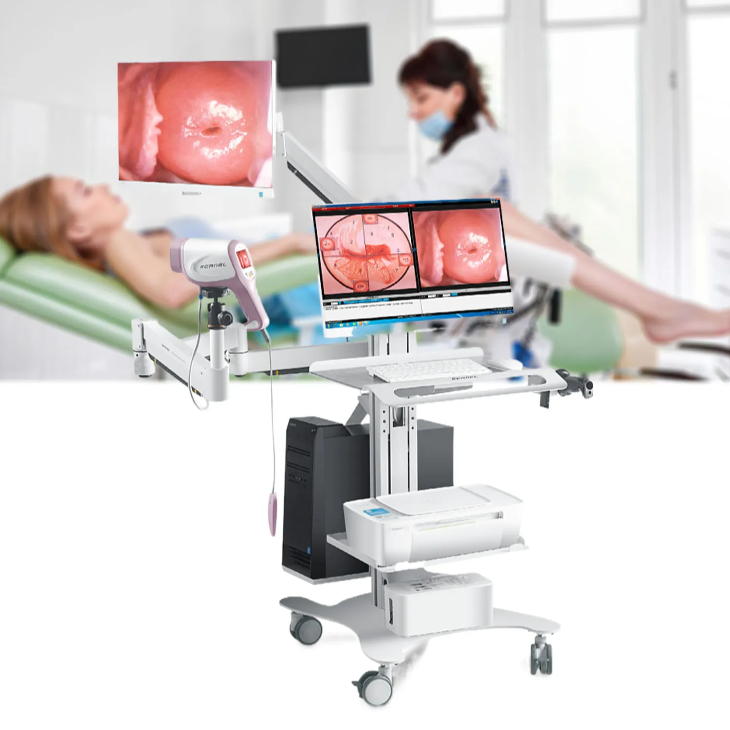 Kernel KN2200I HD CCD Camera Digital Video Kernel Optic Colposcope for Gynecology Colposcopy with Software