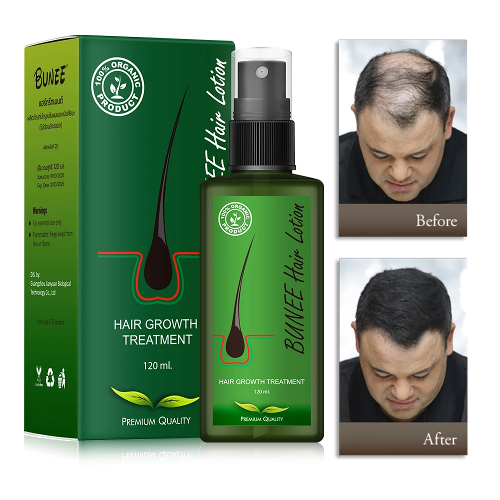 Bunee 100ml Promote Hair Regrowth Anti Loss Gingseng Herbal Biotin Hair ...