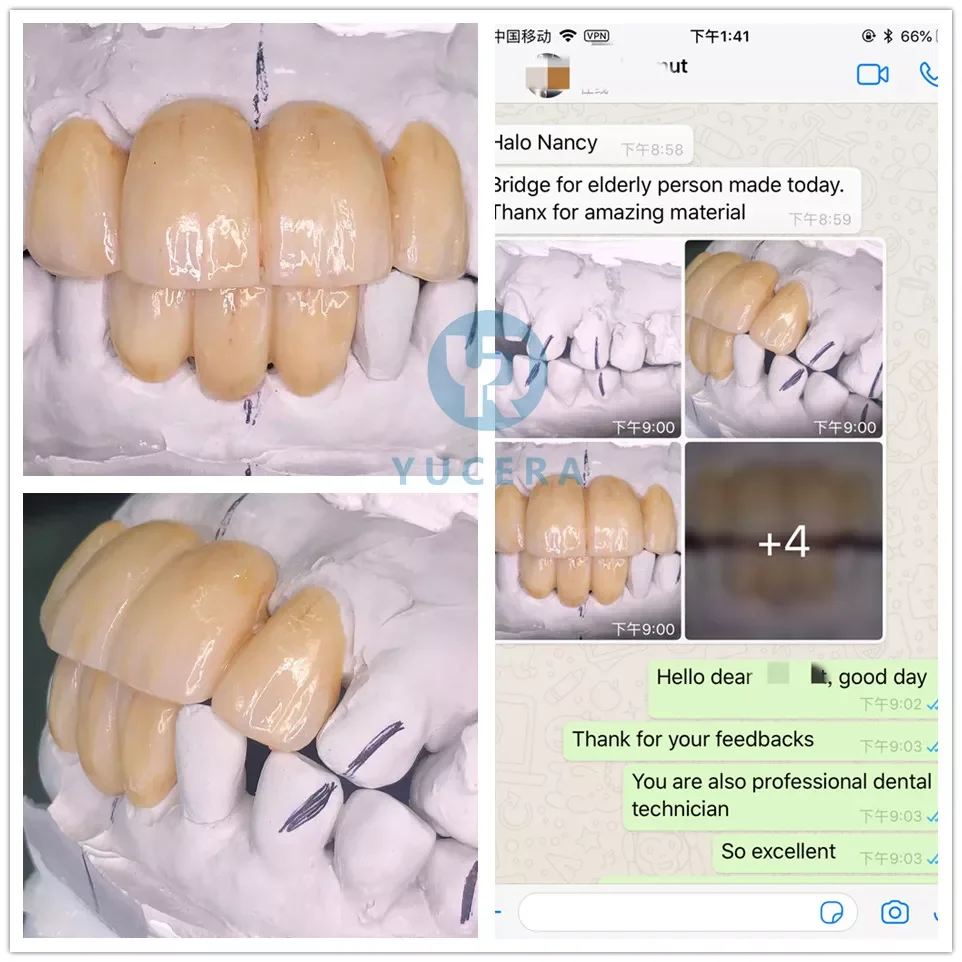 Dental Lab CAD CAM Super Translucent Zirconia Block Dioxide Zirconium Disc Beautiful Porcelain Aesthetics 10-25mm Sizes