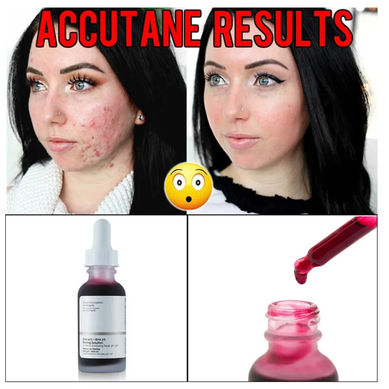 Niacinamide 10 Zinc 1 Hyaluronic Acid B5 Aha Peeling Buffet Lactic