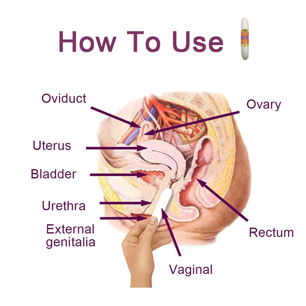 Tugilgandan keyin vagina qattiq emas
