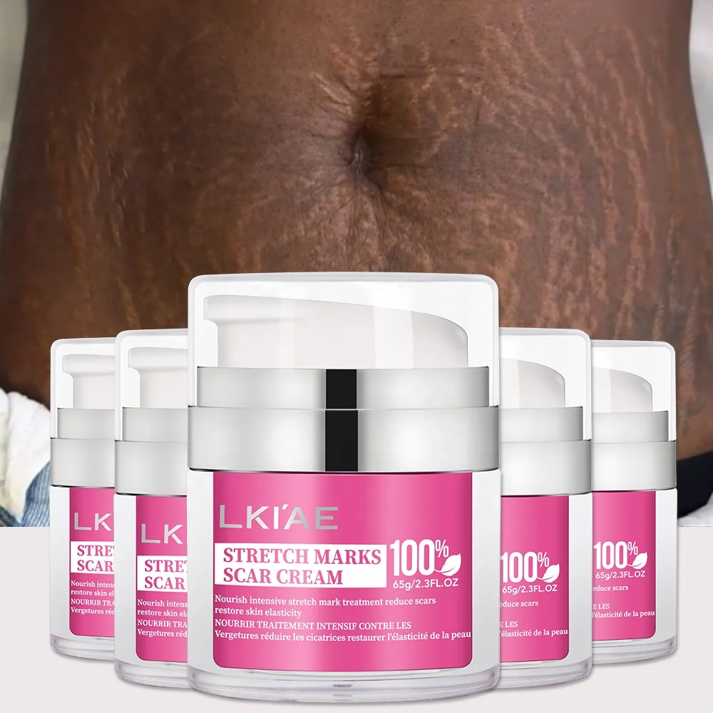 l-carnitine stretch mark cream with Vitamins A-C-E (6 oz) LA Bodies Stretch Mark Care Body Cream