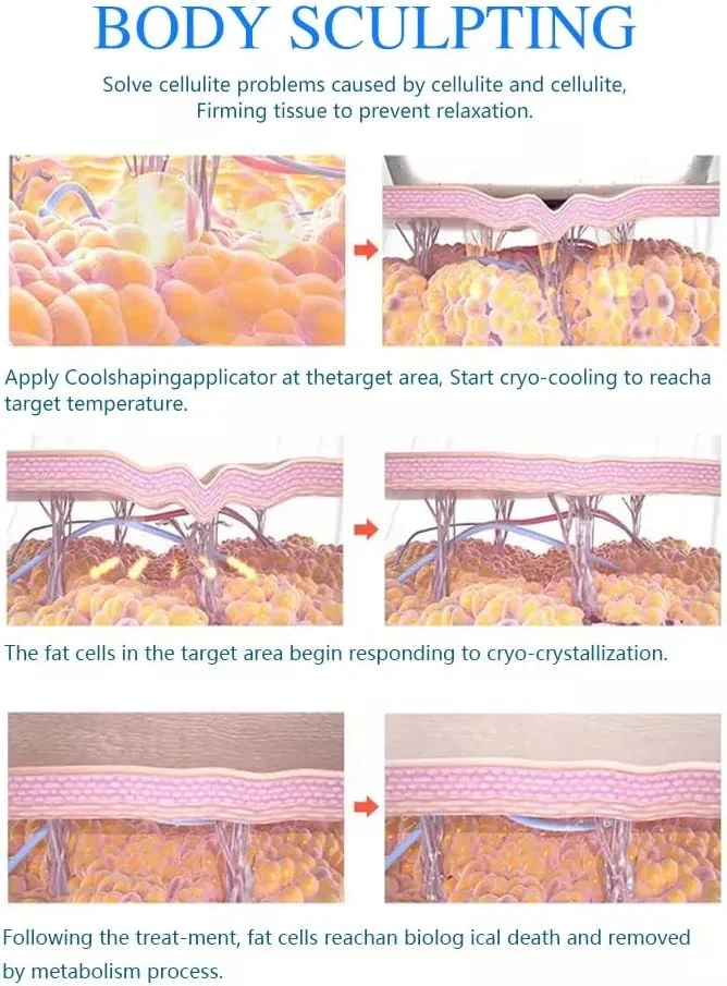 Cryolipolysis Machine with 8 Cryo Paddles for Fat Reduction & Body Sculpting 6 Discover the professional Cryolipolysis Machine with 8 Cryo Paddles for non-invasive fat freezing, body contouring, slimming, and salon body sculpting treatments. Designed for aesthetic clinics, med spas, and beauty salons seeking advanced multi-handle cryotherapy technology. Cryolipolysis Machine with 8 Cryo Paddles for Fat Reduction & Body Sculpting