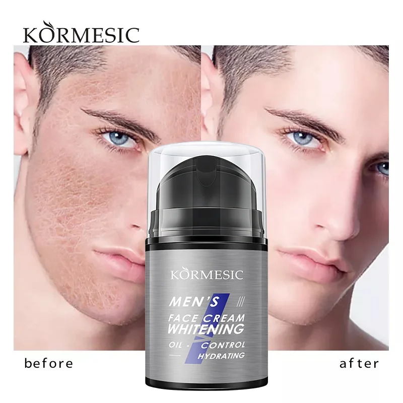 Oem Hot Sales Kormesic Skin Cream Skin Whitening Face Cream For Men Buy Whitening Cream For Men Skin Whitening Face Cream For Men Face Whitening Cream For Men Product on Alibaba