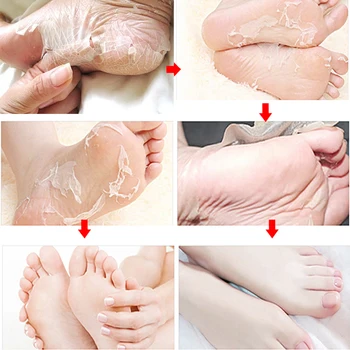 EFERO 3Pair=6PCS Peeling Foot Mask Exfoliating Scrub