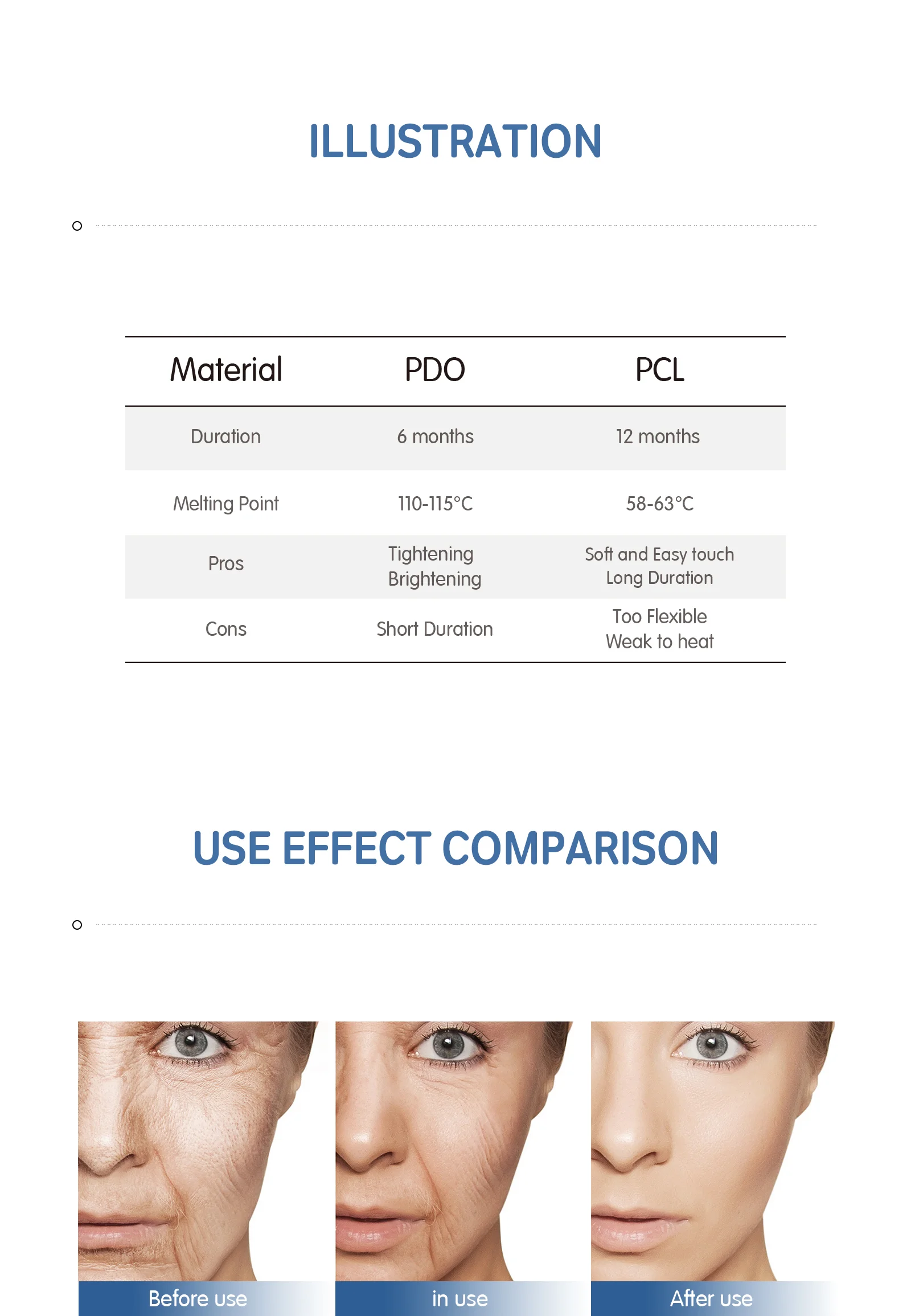 Pdo Reshape Nose Nasal Thread Lift Korea Face L Blunt Cannula 19g 60mm ...