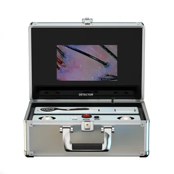 Customized Portable Facial Skin Test Scanner Analyzer Hair Analyzer Machine 50X 200X Magnifier Hair Follicle Scalp Detector 702