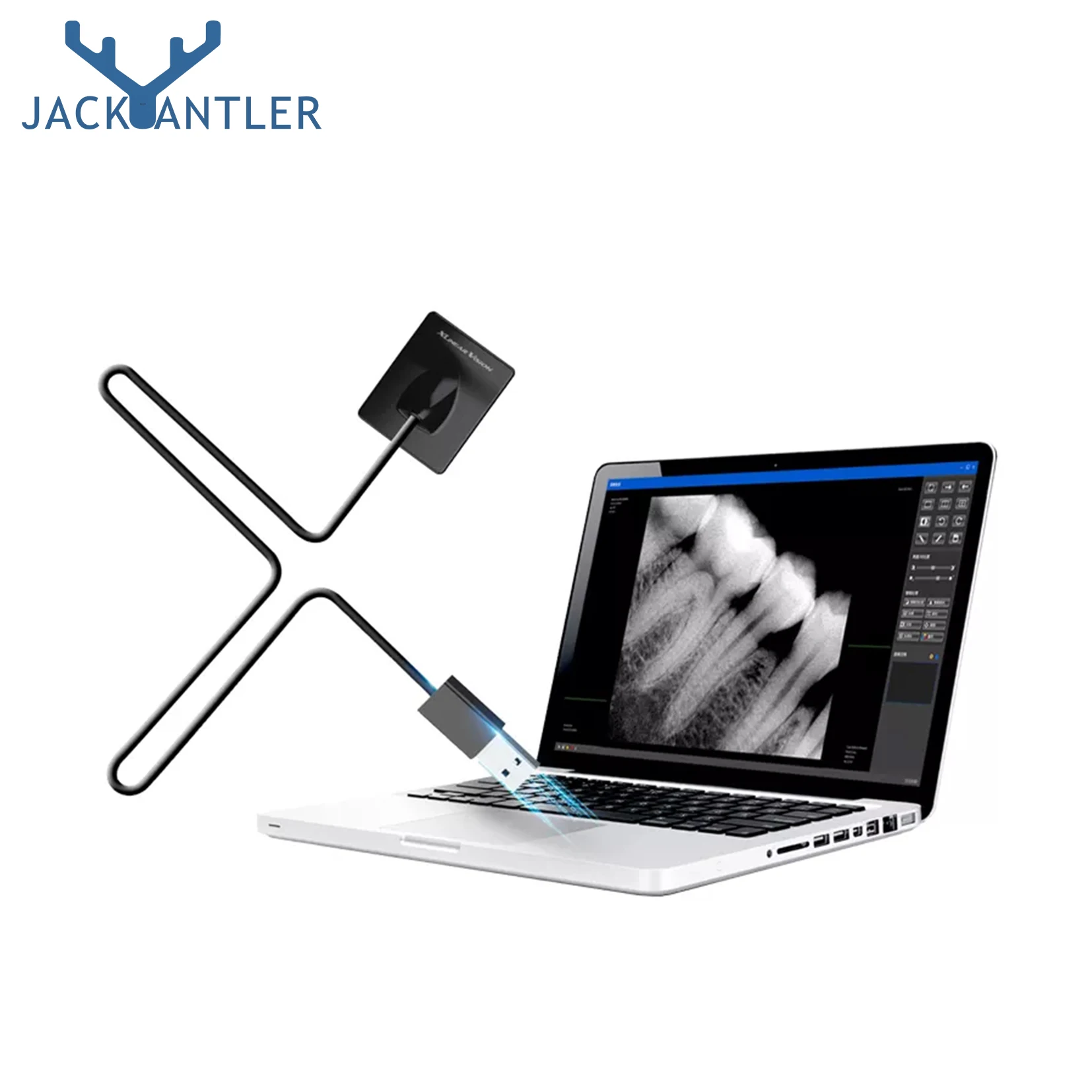 Dental Intraoral Xray Sensor High Efficiency For Use Buy Dental Xray