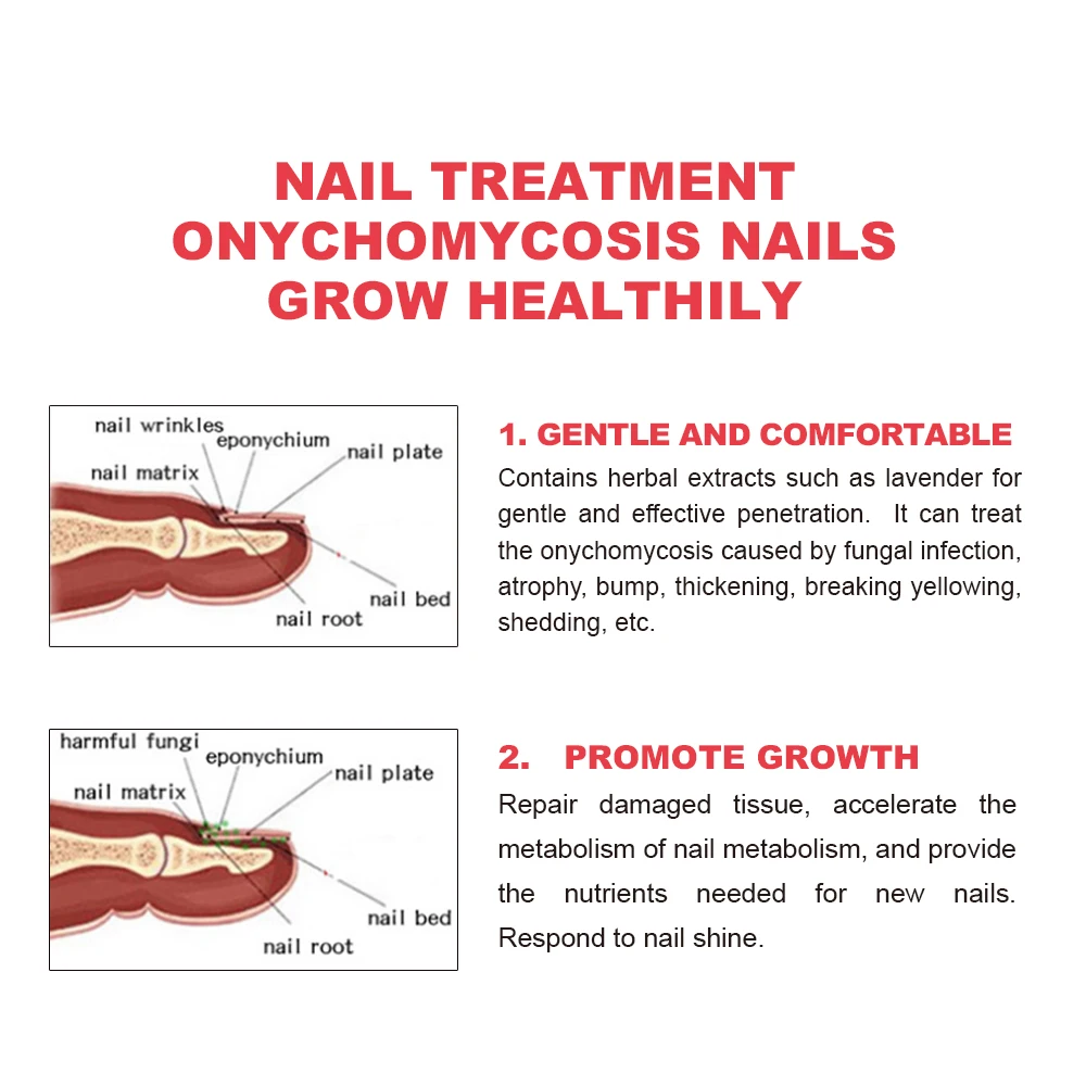 PARONYCHIA - GlossaryLive, image size:1000x1000
