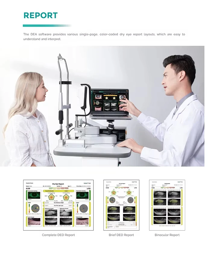 Ophthalmic Dry Eye Analyzer Dry Eye Examination Surface Analyzer Complete Dry Eye Diagnosis