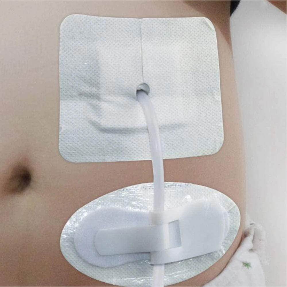 Medical Catheter Stabilization Device Legband Sticker Catheter Tube Urine Bag Holder