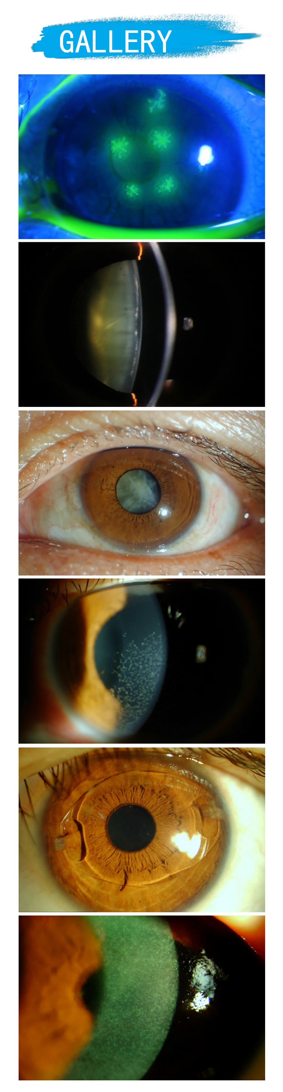 LS-4 Five Magnifications Ophthalmology Slit Lamp Optometry Microscope with LED Illumination Optical Biomicroscope