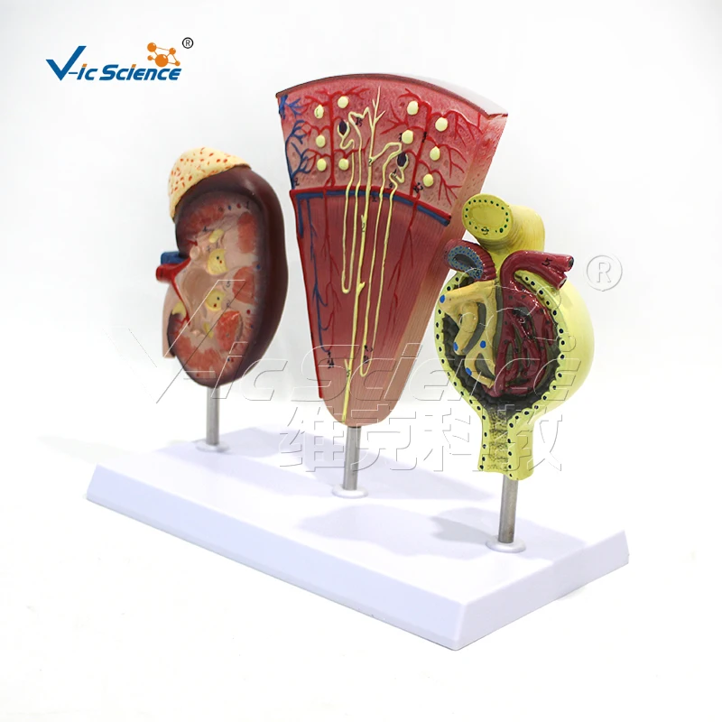 Почечная анатомическая модель нефроновая гломерулярная