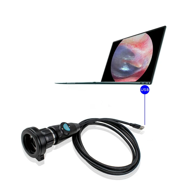 Lightweight FHD Portable Endoscopic Camera for ENT Surgery USB3.0 Endoscopic Camera