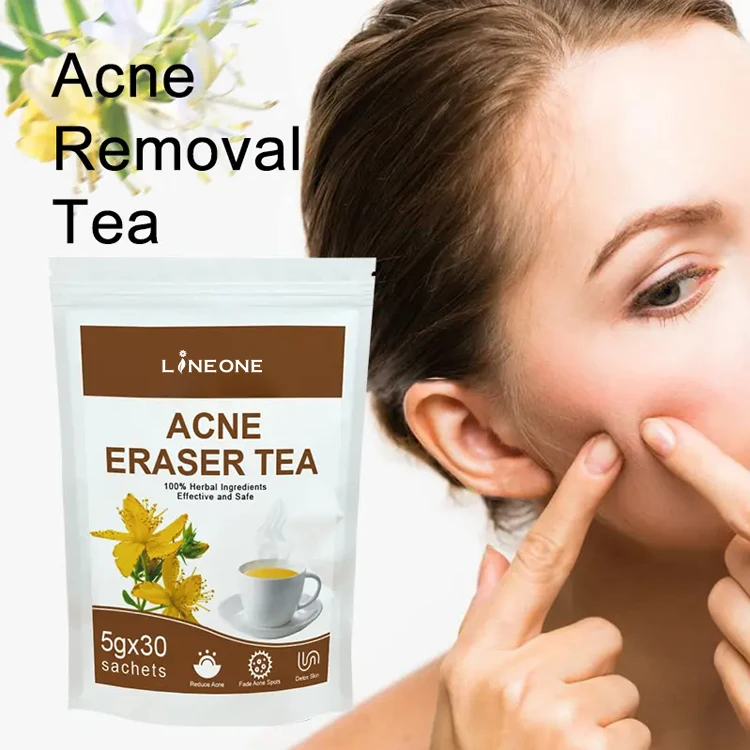 Private label ACNE Eraser Tea 100% Herbal Acne Tea Skin Beautiful Health 100% Herbal Acne Supplement Powder Tea factory