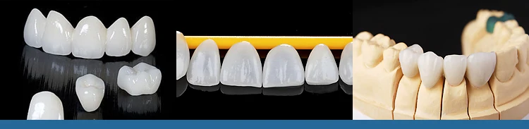 Dental Chairside Solution Milling Machine Cad Cam Dental Milling ...